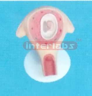 UTERUS WITH EMBRYO (2 MONTHS)